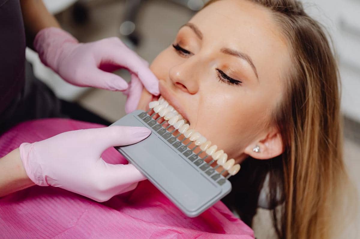 perbedaan veneer composite dan porcelain