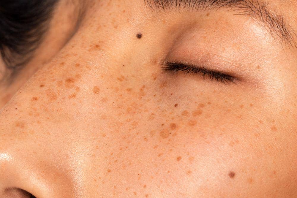 Tanda Serum Tidak Cocok di Wajah