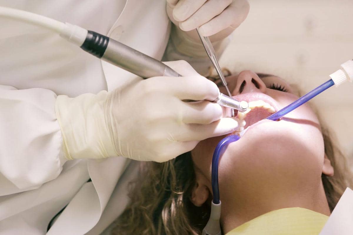 ilustrasi prosedur dental scaling