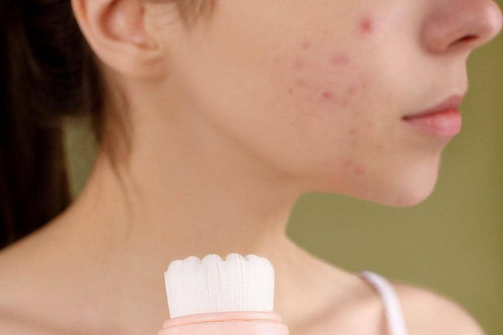 Tanda Moisturizer Tidak Cocok di Wajah