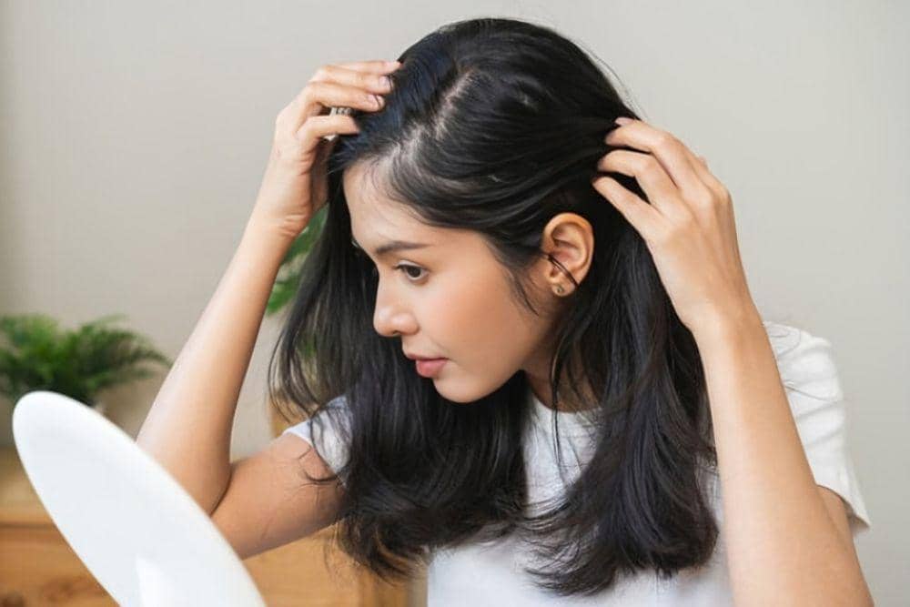 Penyebab Ketombe Meski Sering Keramas
