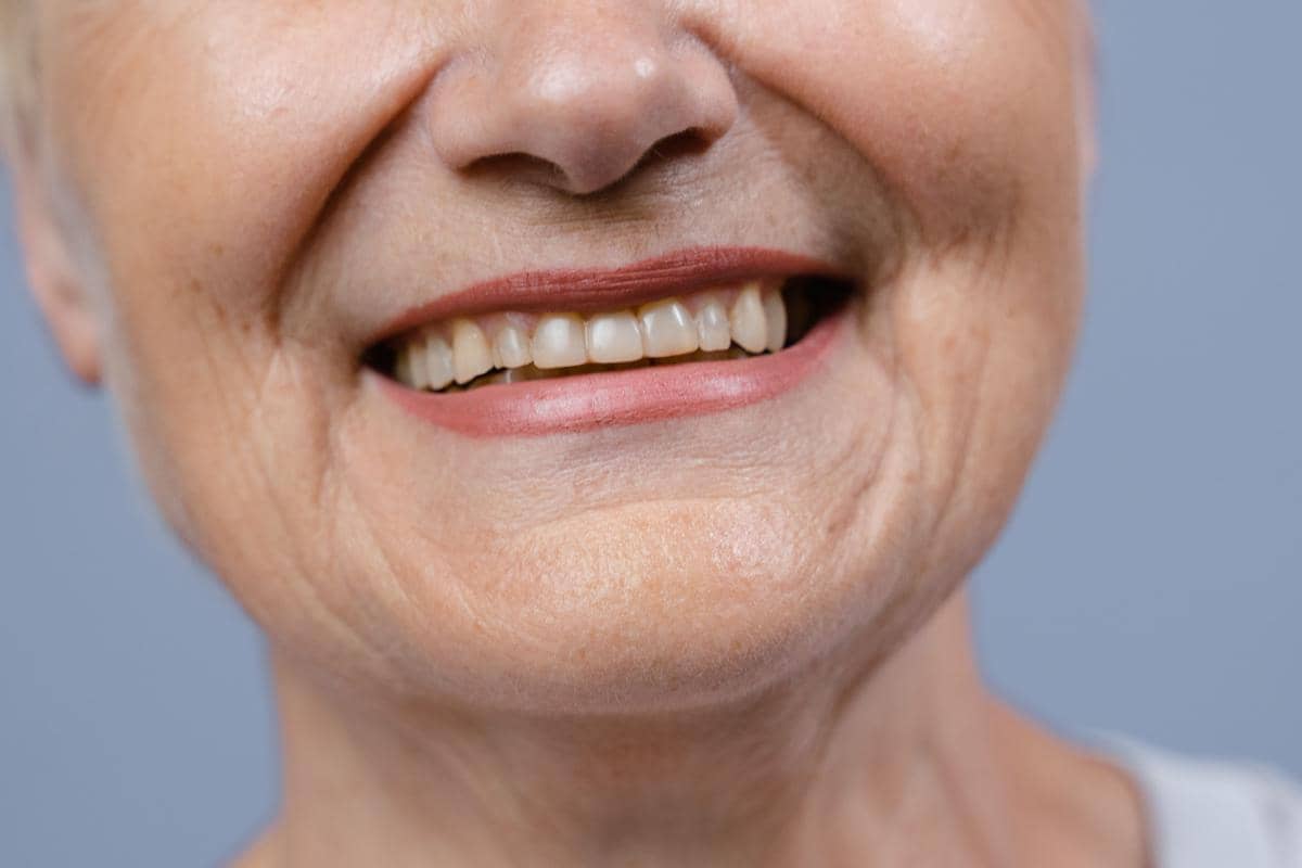 Gigi Kuning
